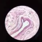 _0